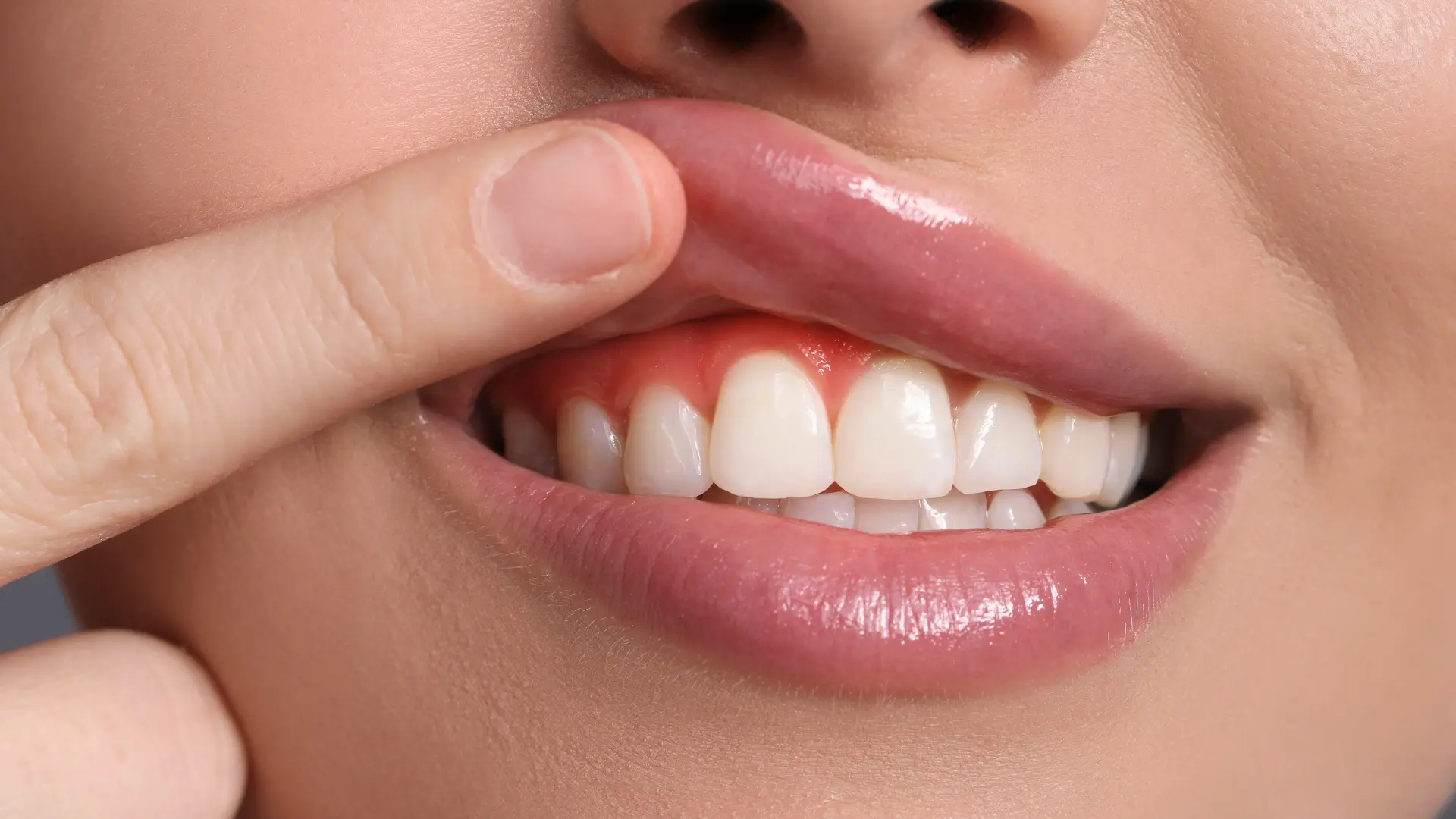 Diş Eti Kanaması Neden Olur